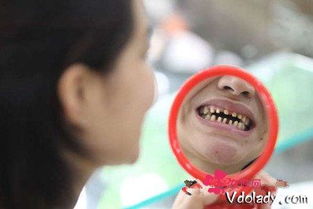 女子被磨掉好牙究竟是怎么回事 12颗牙齿瘦身瓜子壳大小 