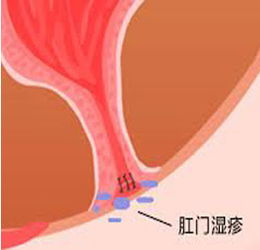 四惠肛肠医院