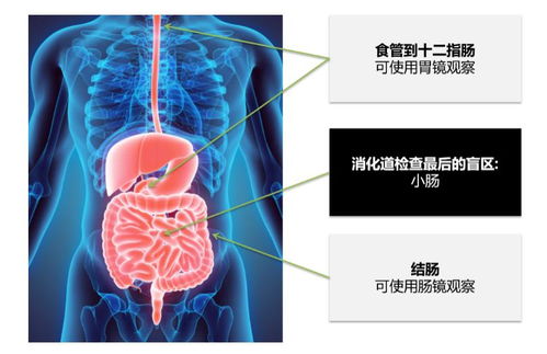 六米长的小肠怎么查 上 