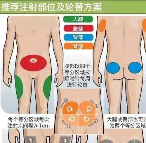 糖尿病打胰岛素好还是吃药好 医生怎么说