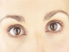讲解对斜视眼的具体预防方法