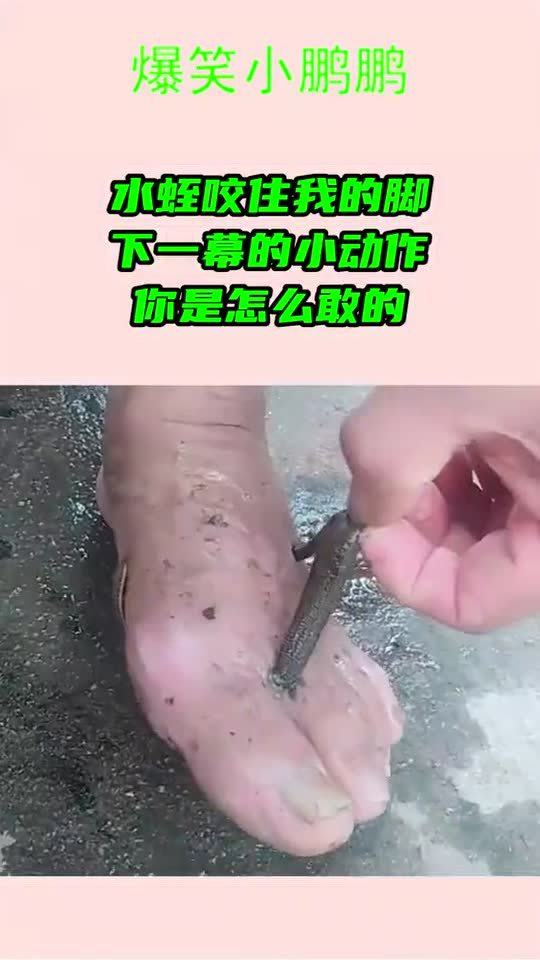 水蛭咬住我的脚,下一幕的小动作,你是怎么敢的3049 