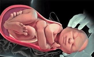 原创分娩的时候，妈妈拼命，胎儿在做什么？