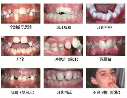 想变帅变美的看过来 附真实对比图看变化过程