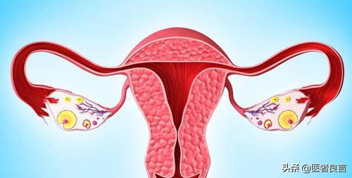 当女人遇上这3种大病,可能需要切除子宫,早知道早预防