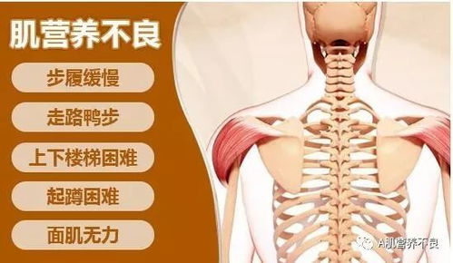 肌营养不良那些症状