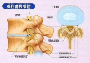 弯腰痛还是伸腰痛 不同痛法原因不同