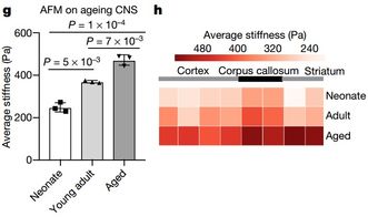 Nature重磅 科学家成功逆转大鼠的大脑干细胞衰老进程