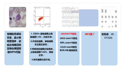 脾脏肿大提示骨髓纤维化 这些指标是答案