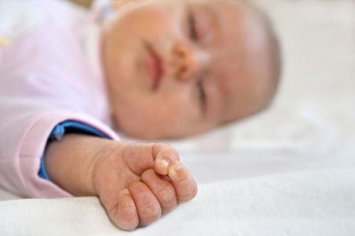 新生儿会出现脑缺氧吗 儿科医生 这样做可做好预防
