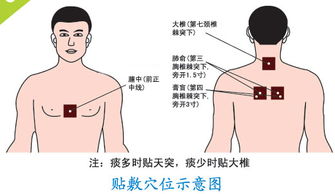 三伏贴穴位