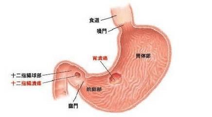 请问葵花胃康宁 治疗胃肠疾病效果怎么样