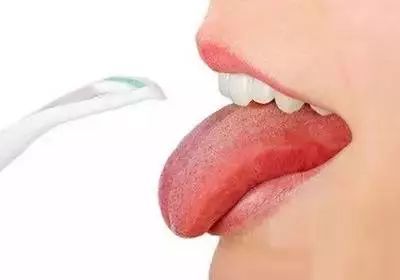 舌苔颜色暗示身体疾病 教你通过舌苔辨别健康状况