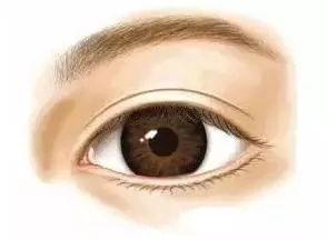 肿泡眼适合做哪种类型的双眼皮 肿泡眼割双眼皮应该注意的事项 