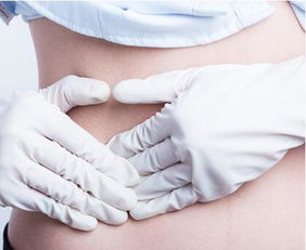 卵巢囊肿手术后需要注意的7个事项，保证术后恢复效果