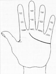掌纹可随病理发生变化 有预测疾病功效 掌纹手相 