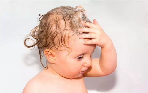 宝宝头发稀少 面对 秃顶宝宝 妈妈该如何应对