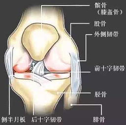 膝疼 带你走近髌骨软骨软化及其治疗