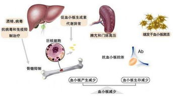 难波舞茸 肝硬化能活多久 