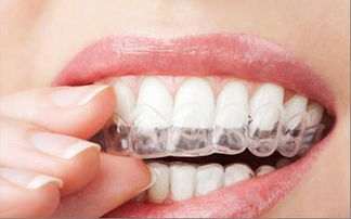 牙齿矫正期间应该怎样清洁口腔呢