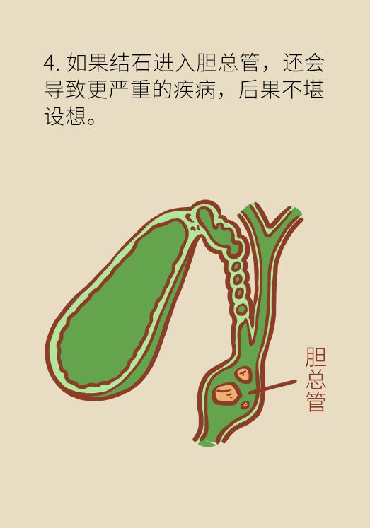 体检发现胆囊结石,必须要切掉吗 看完或明白