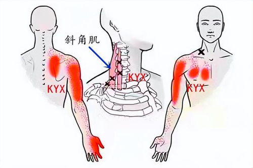 肩部疼痛是怎么回事(肩部酸疼是怎么回事)