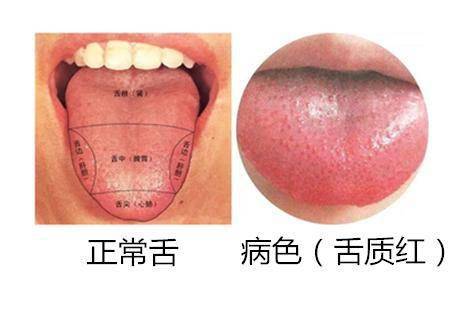 红色瘀斑舌薄白苔 信息评鉴中心 酷米资讯 Kumizx Com