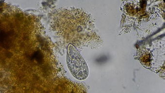 显微镜下的细菌微生物视频模板素材 高清格式下载 视频42.08MB 医疗教育 实拍视频大全 