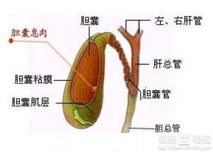 胆囊息肉的手术指征