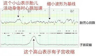 胎心监护合格标准图 图片欣赏中心 急不急图文 Jpjww Com