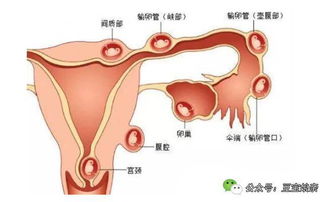 怀孕3次都打掉了,40岁时再次怀孕,结局让人惋惜 