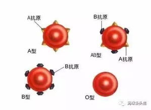 O型妈妈的恐慌,一篇教你简单判定宝宝是否存在ABO溶血风险 