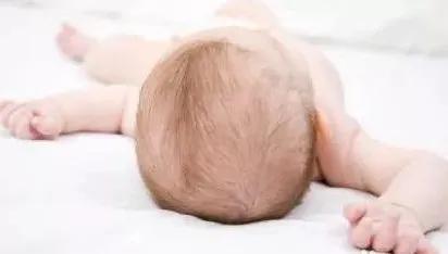 宝宝的头发又黄又稀
