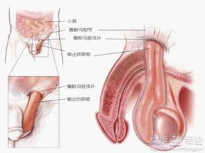 男人为什么会得疝气，得了疝气要怎么办