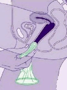 性刺激下，女人阴部能容纳多大丁丁