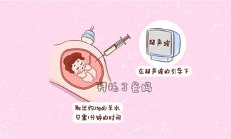 孕期一定要做羊水穿刺吗 这几类孕妈妈需要做羊水穿刺,有你吗