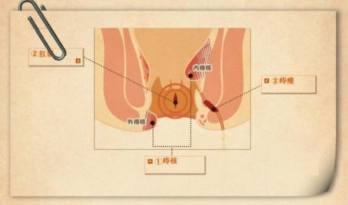 汉氏痔必康三十年一路前行,行业的璀璨明星 