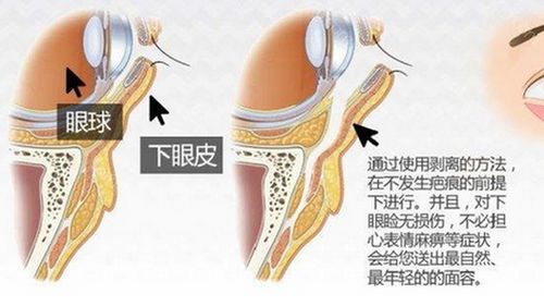 你有印第安纹吗