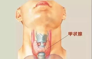 每个被 甲状腺结节 吓过的人,都该尽量拥有这五大好习惯