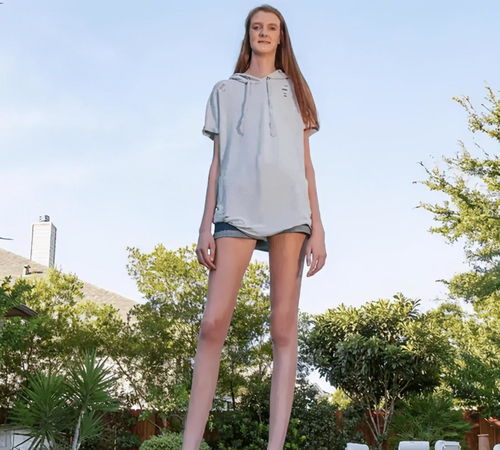 腿长1米35,这个打破世界最长腿记录的17岁女孩,总身高是多少