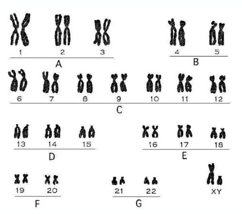 泰国第三代试管婴儿筛选5对染色体和23对染色体的区别