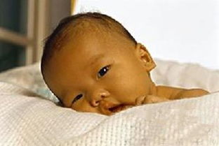 新生儿黄疸如何处理，新生儿黄疸应该如何处理科学的做法是什么