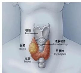 甲状腺穿刺 没你想得这么可怕 上海市甲状腺疾病研究中心 宜兴分中心十月专家坐诊时间表