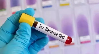 性激素六项能查出啥病，女性性激素六项检查都能查出什么病