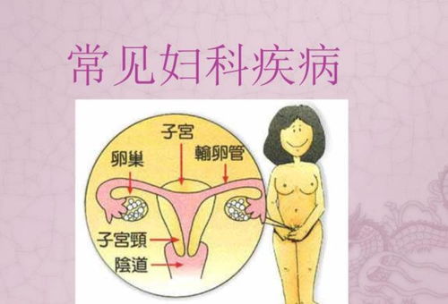 女人有妇科病,嘴巴可能发生4种变化,不妨对照自查一下