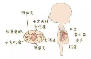 女人湿气重的症状图片 湿气重，身体有什么变化？该怎么办？ 