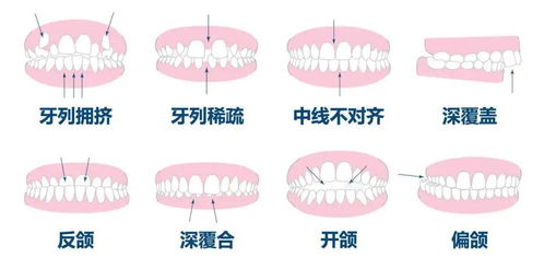 你真的了解你的牙齿咬合吗 四个小动作,检查出你的牙列是否正常