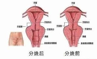 怎样缩阴有效果