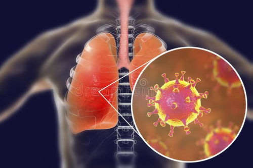 得了新冠病毒后遗症说话多了就会咳嗽怎么回事（新冠病毒为什么会导致咳嗽） 第1张