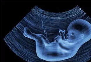彩超对胎儿的影响(怀孕期间多次做B超和排畸彩超)